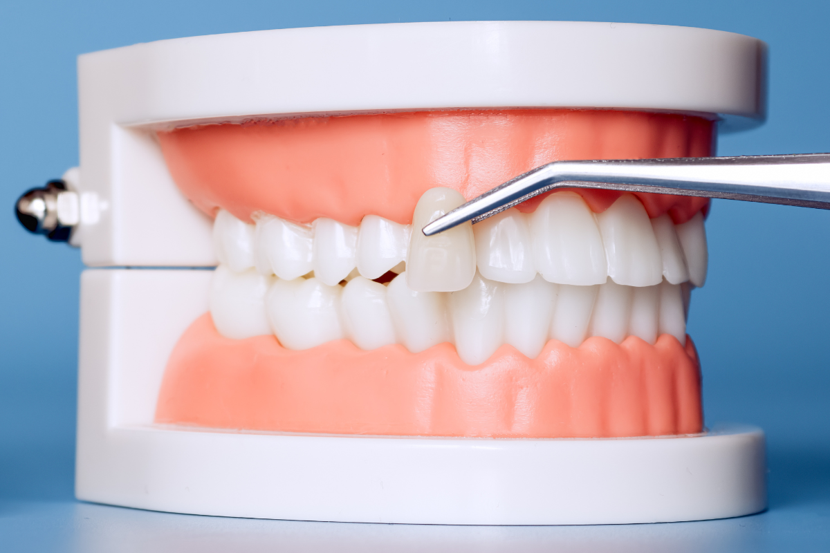 Cosmetic Dentistr (19)